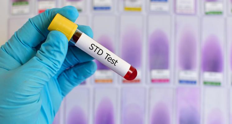 What Is Included in an STD Test in Dubai?