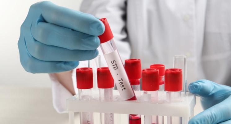 How Much Does an STD Test Cost in Dubai?